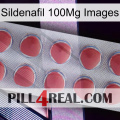 Sildenafil 100Mg Images 18